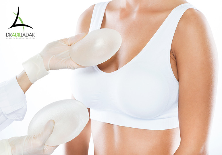 Alberta Plastic Surgery - Breast Surgery — Breast Augmentation - What You Need To Know